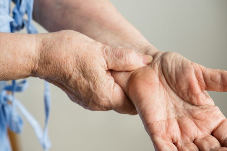 Carpal Tunnel Treatment: Early Signs You Shouldn’t Ignore