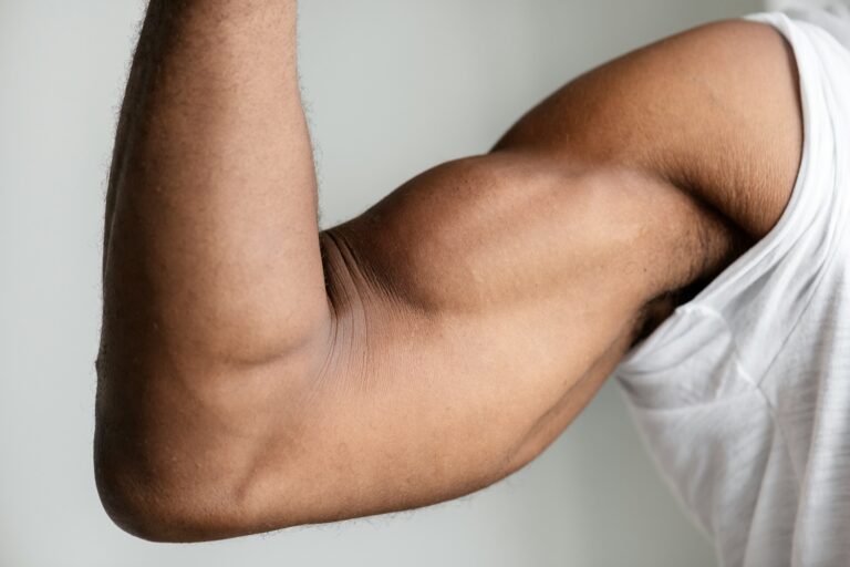 Why Bicep Tendinitis Is Often a Shoulder Mechanics Issue
